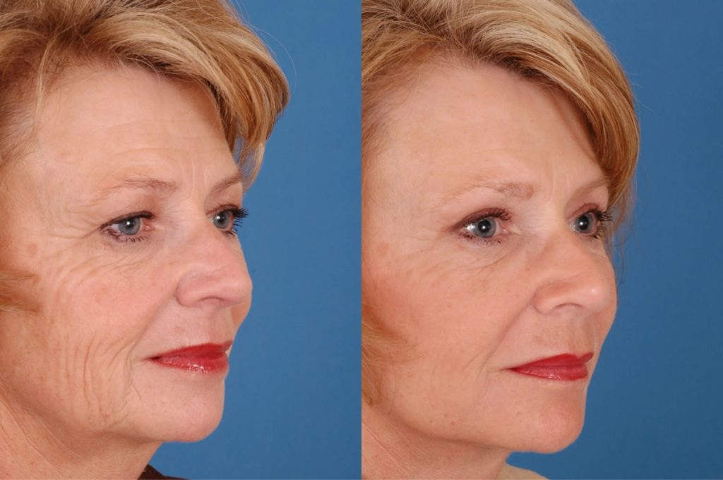 2025 02 afps face patient 1 2025 02 afps face patient 1