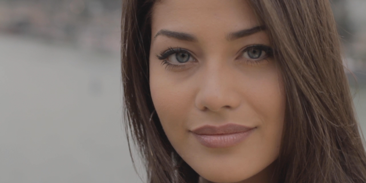 Afps blepharoplasty Afps blepharoplasty